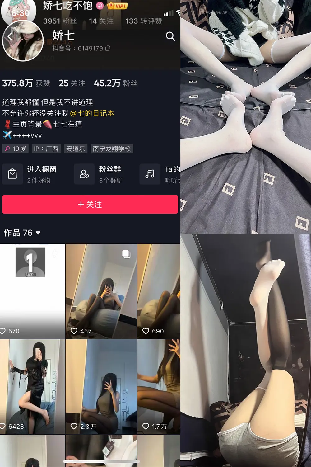 抖音 娇七 微密圈 NO.004期 [63P]-微密部落