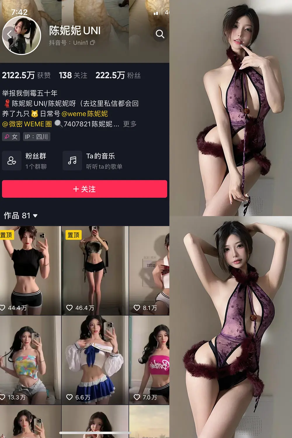 抖音 陈妮腻UNI 微密圈 NO.075期 [37P]最新至：2024.1.10-微密部落