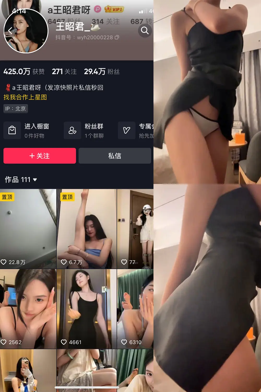 抖音 王昭君 微密圈 NO.010期 [11P1V]最新至：2023.6.10-微密部落