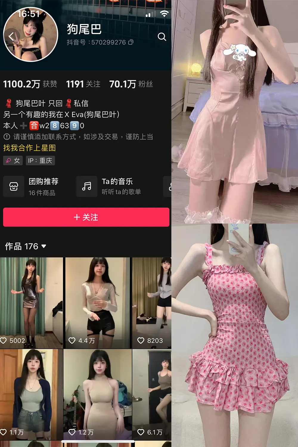 抖音 狗尾巴 微密圈 NO.004期 [25P5V]-微密部落