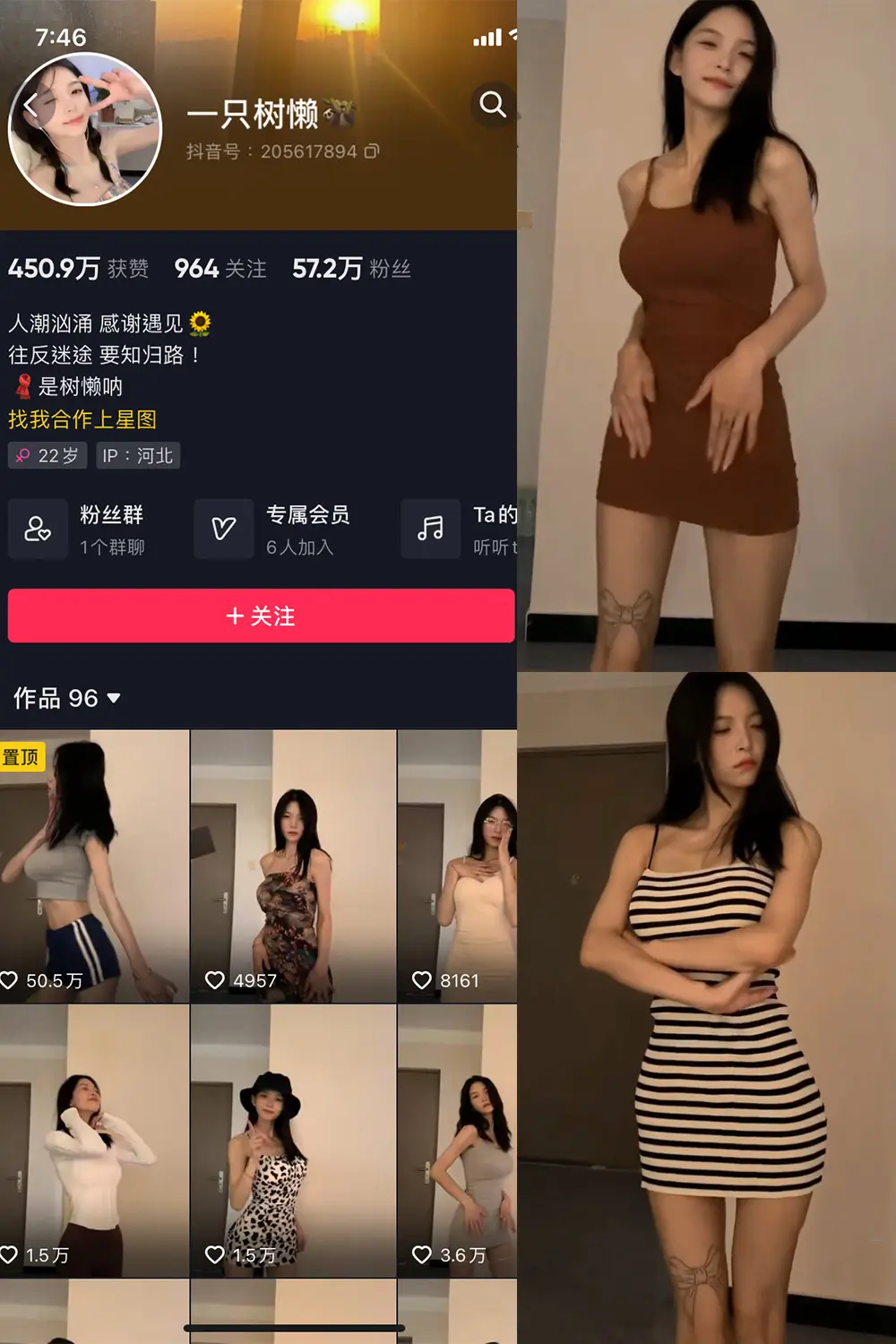 抖音 一只树懒 微密圈 NO.004期 [21P10V]-微密部落