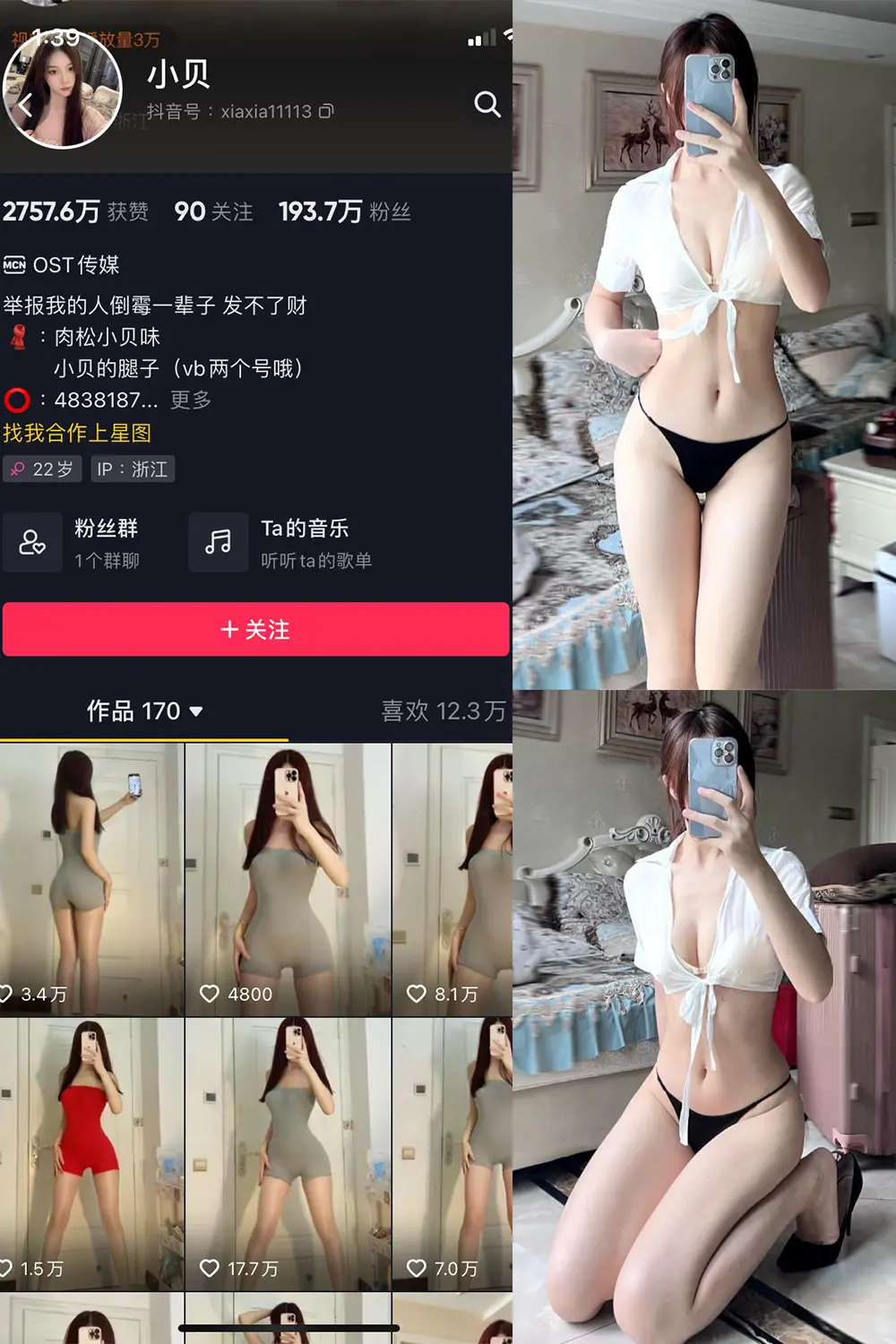 抖音 小贝 VIP 微密圈 NO.005期 [28P]-微密部落