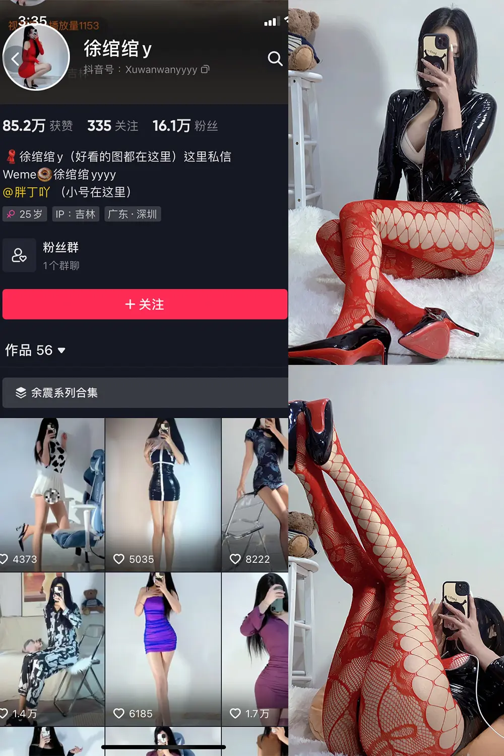 抖音 徐绾绾 微密圈 NO.009期 [18V]-微密部落