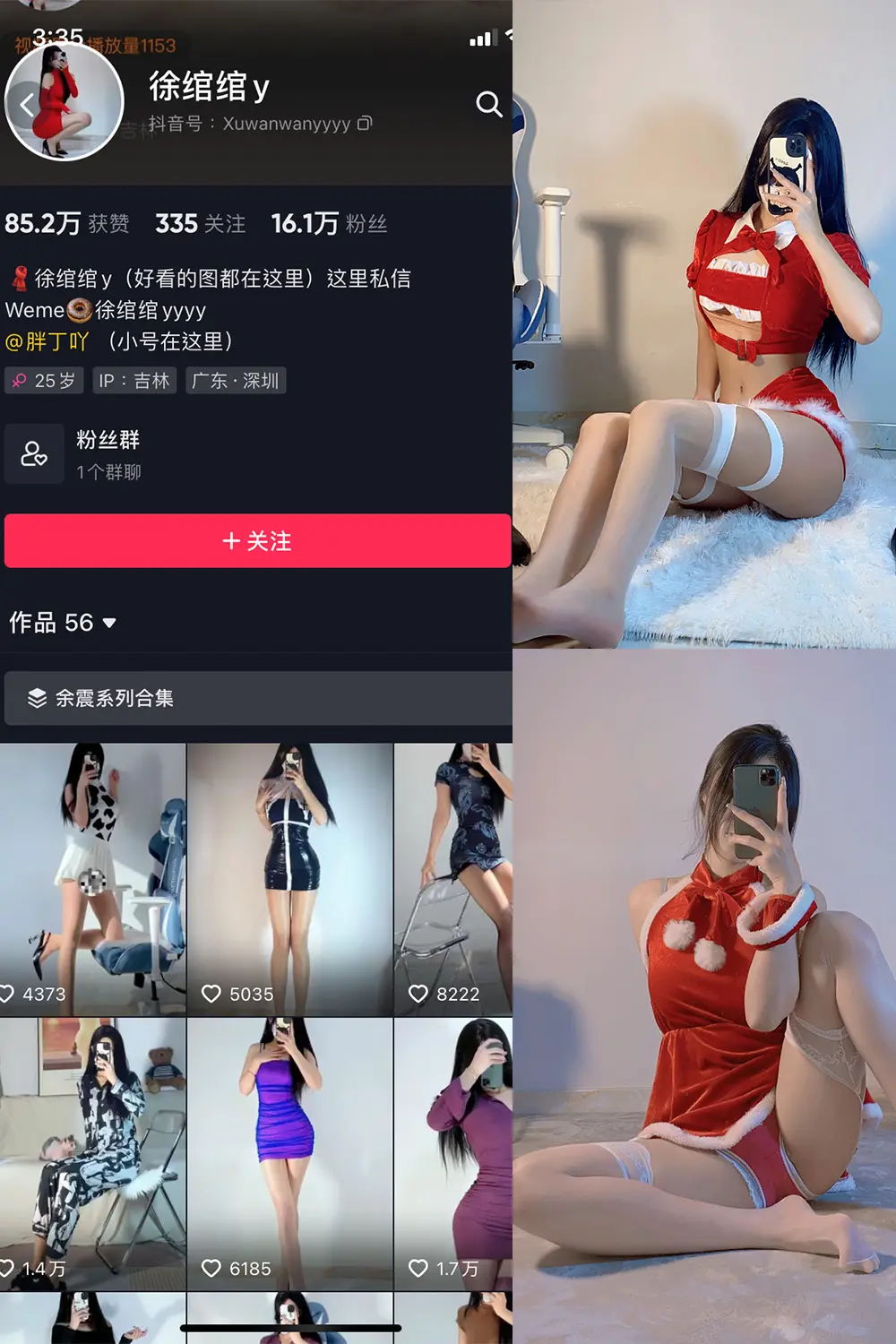 抖音 徐绾绾 微密圈 NO.010期 [18V]-微密部落