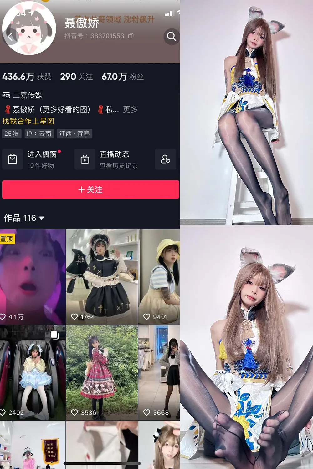 抖音 聂傲娇 微密圈 NO.007期 [34P]-微密部落