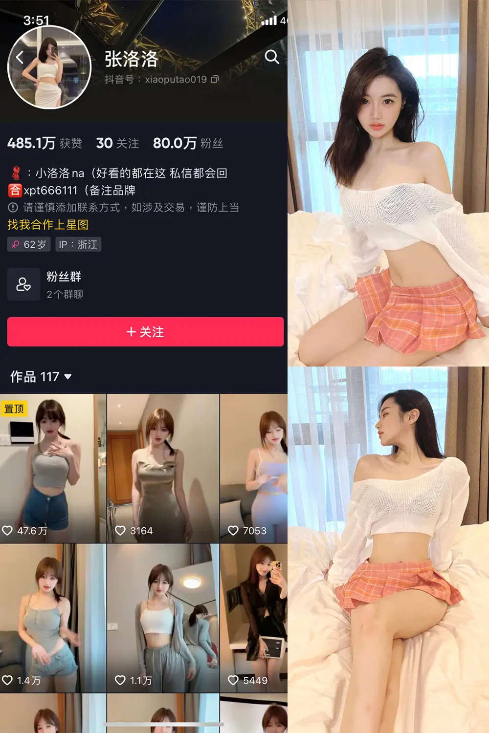 抖音 张洛洛 微密圈 NO.001期 [30P]-微密部落