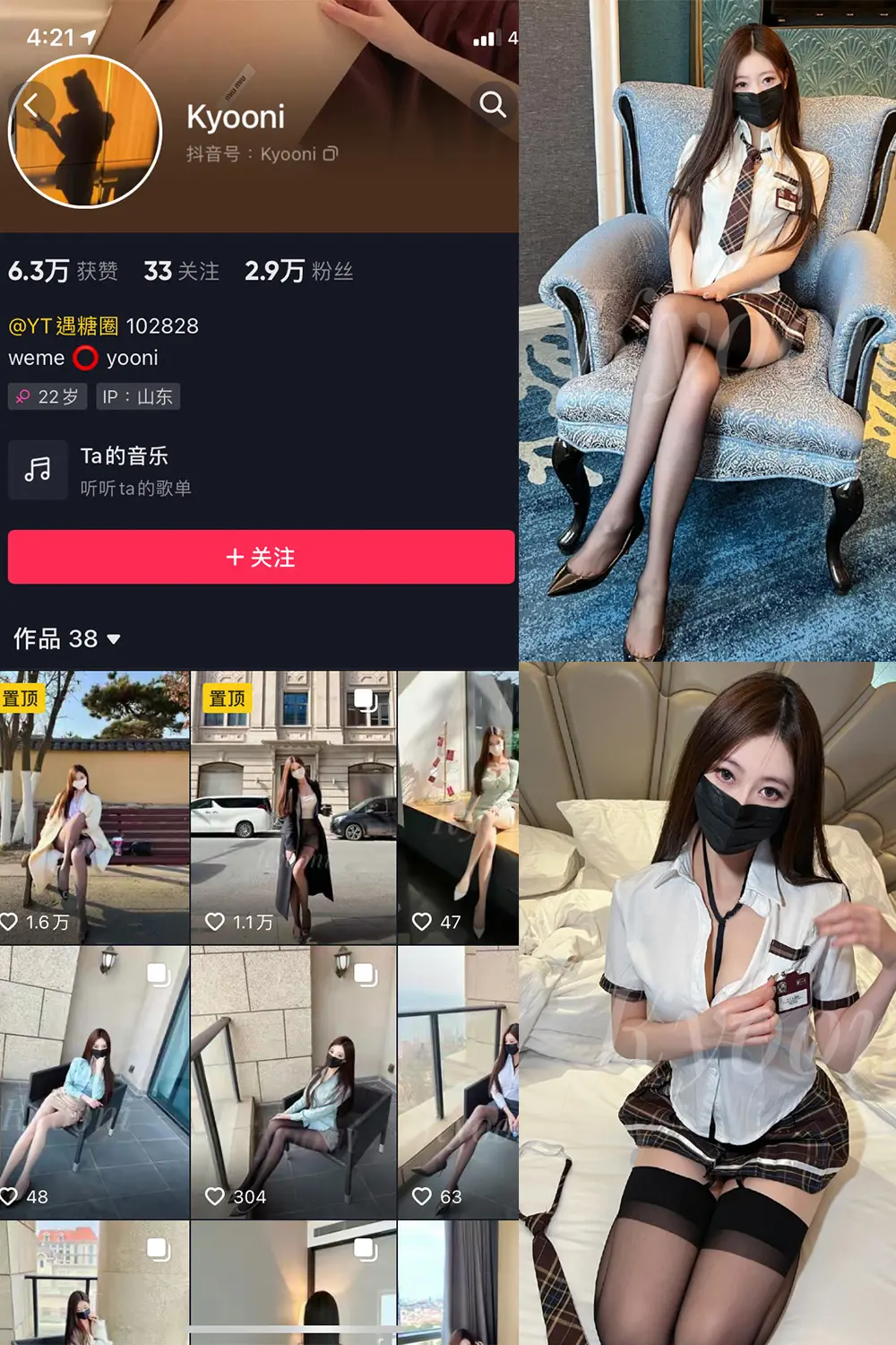 抖音 Yooni有你喵 微密圈 NO.011期 [24P]-微密部落