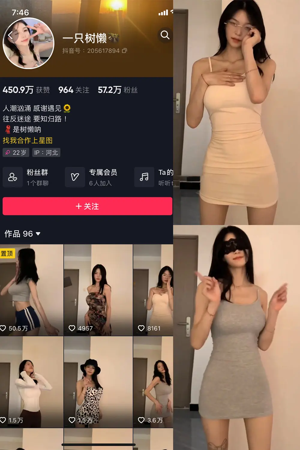 抖音 一只树懒 微密圈 NO.003期 [2P10V]-微密部落