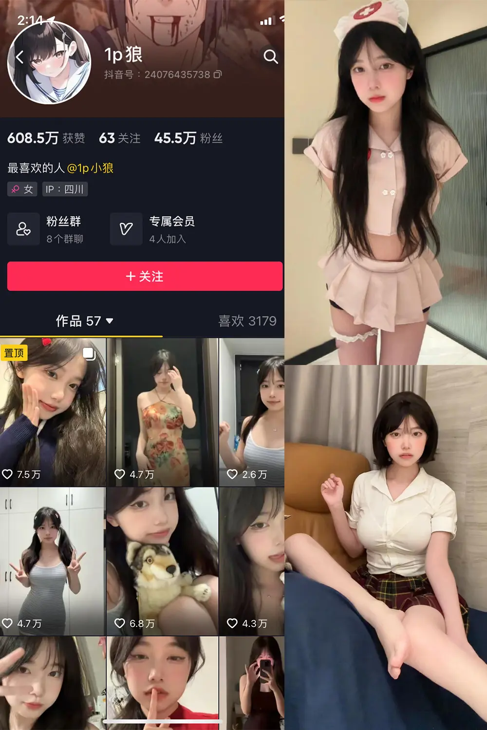 抖音 1p狼 微密圈 NO.006期 [失效]-微密部落