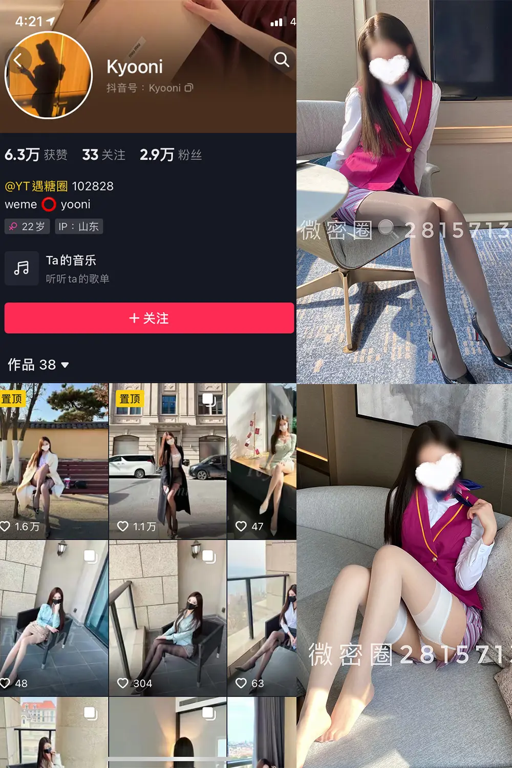 抖音 Yooni有你喵 微密圈 NO.004期 [49P]-微密部落