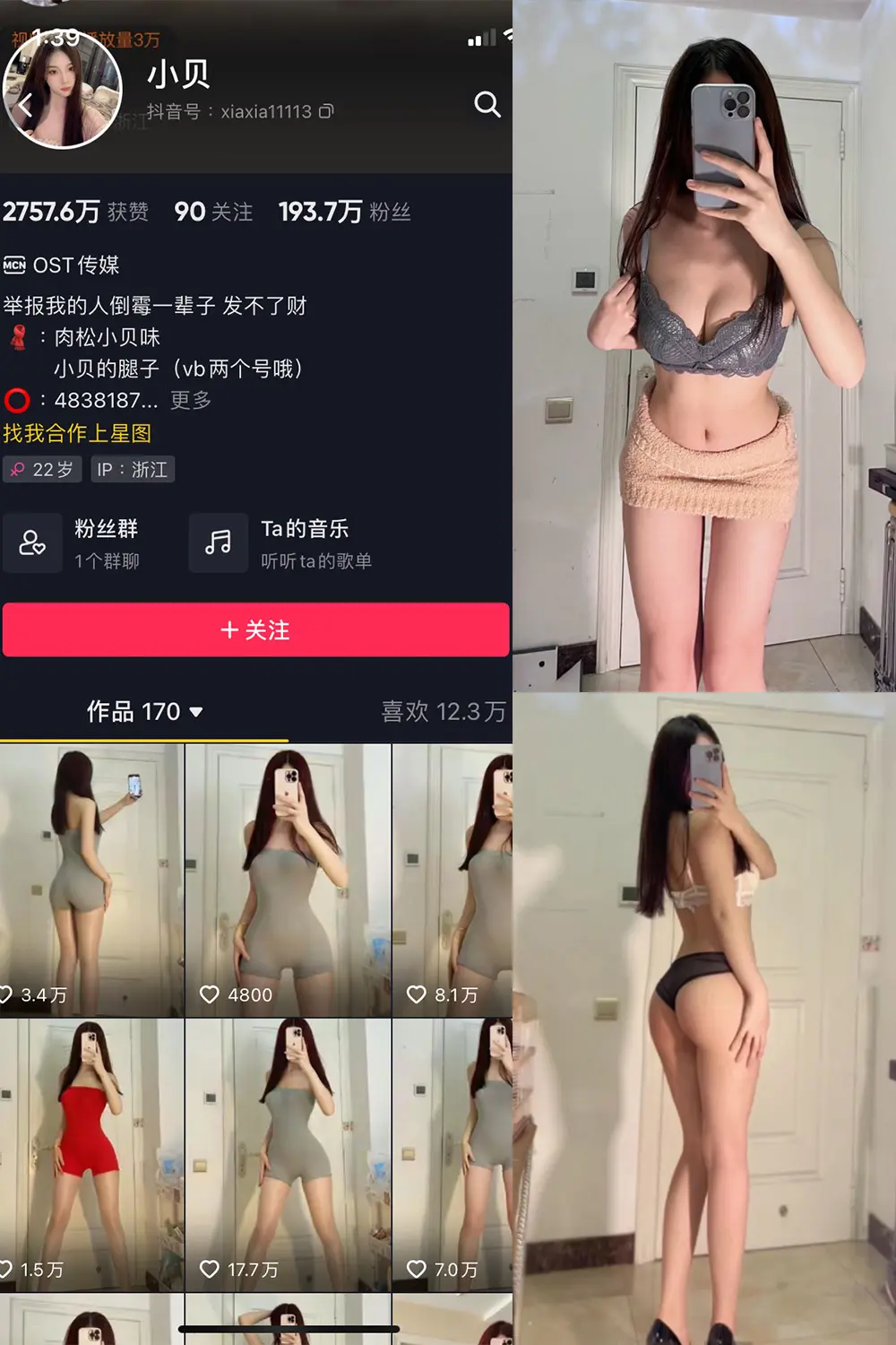 抖音 小贝 VIP 微密圈 NO.002期 [33P]-微密部落