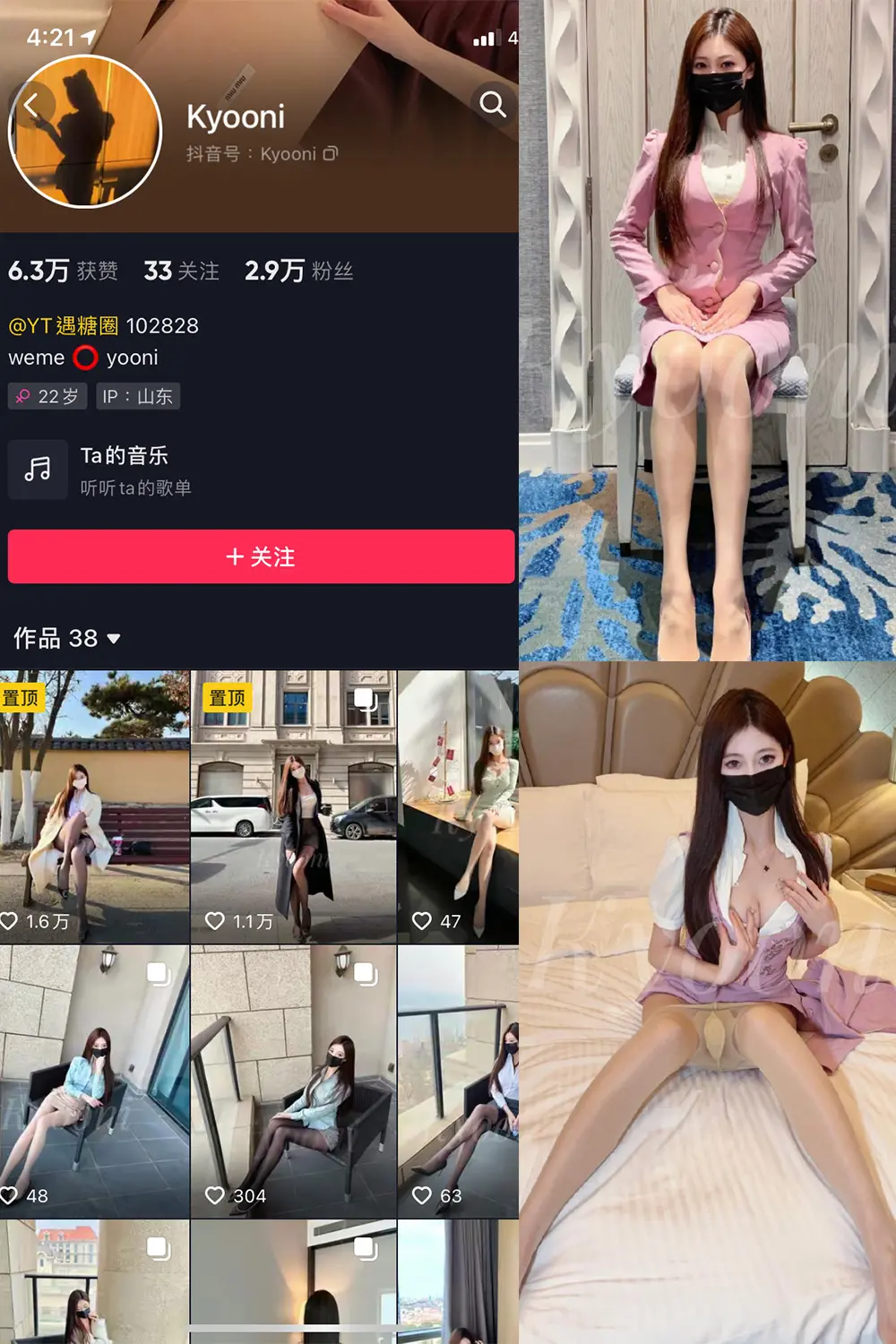 抖音 Yooni有你喵 微密圈 NO.010期 [33P]-微密部落