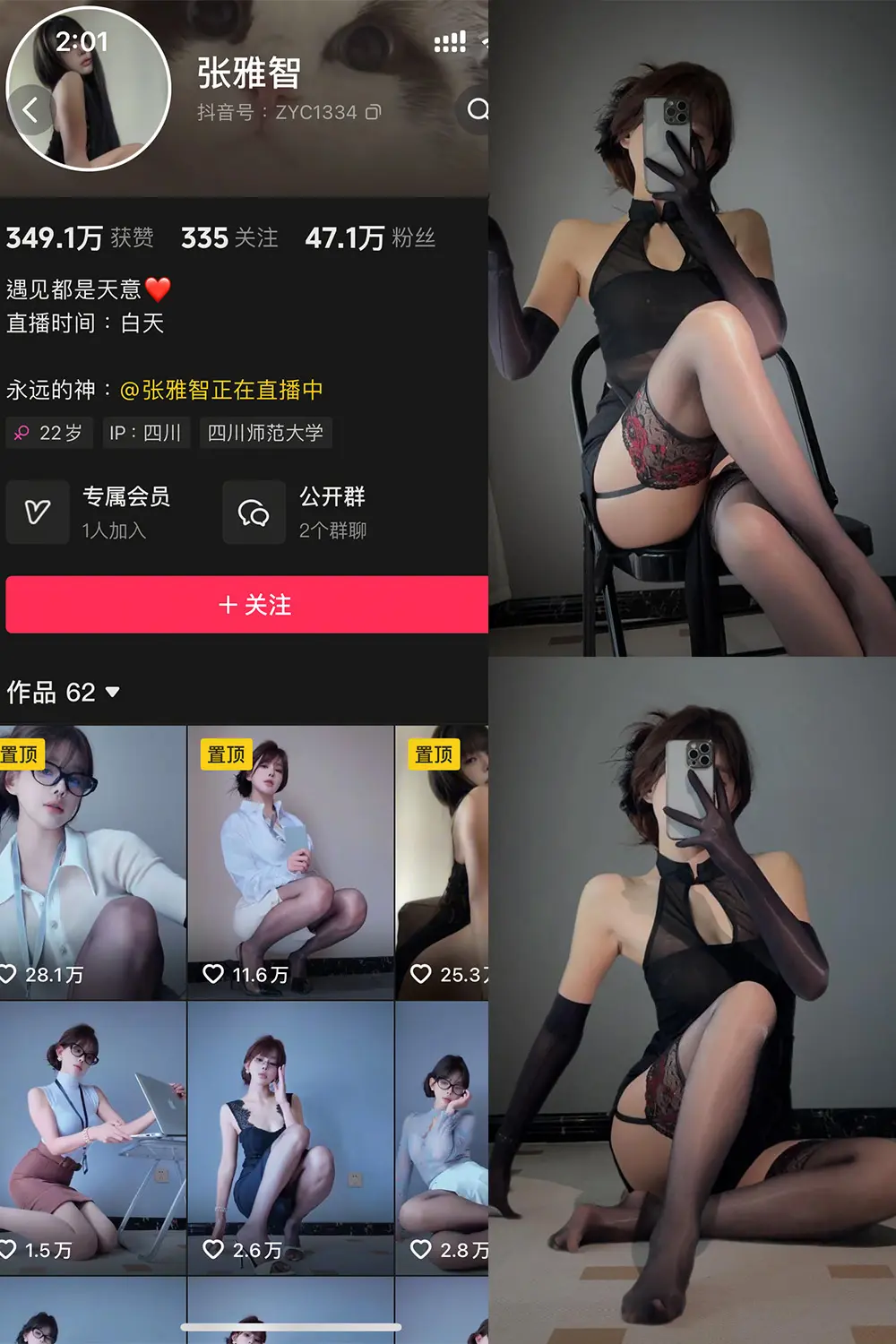 抖音 张雅智 铁粉空间 NO.001期 [21P]-微密部落