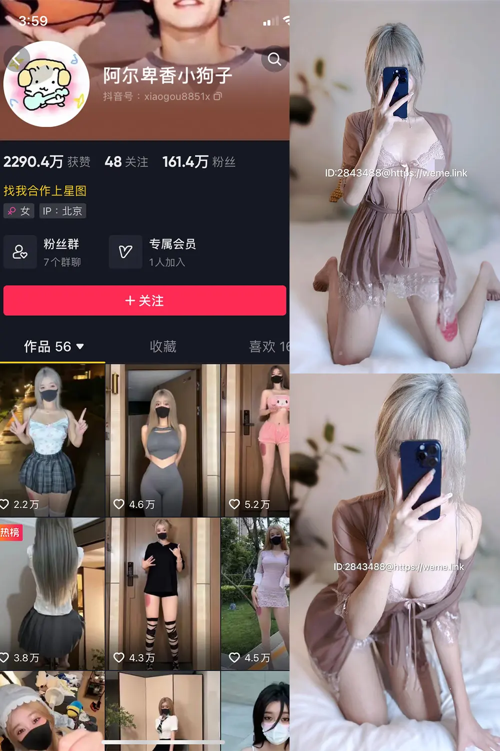 抖音 阿尔卑香小狗子 微密圈 NO.016期 [33P]-微密部落