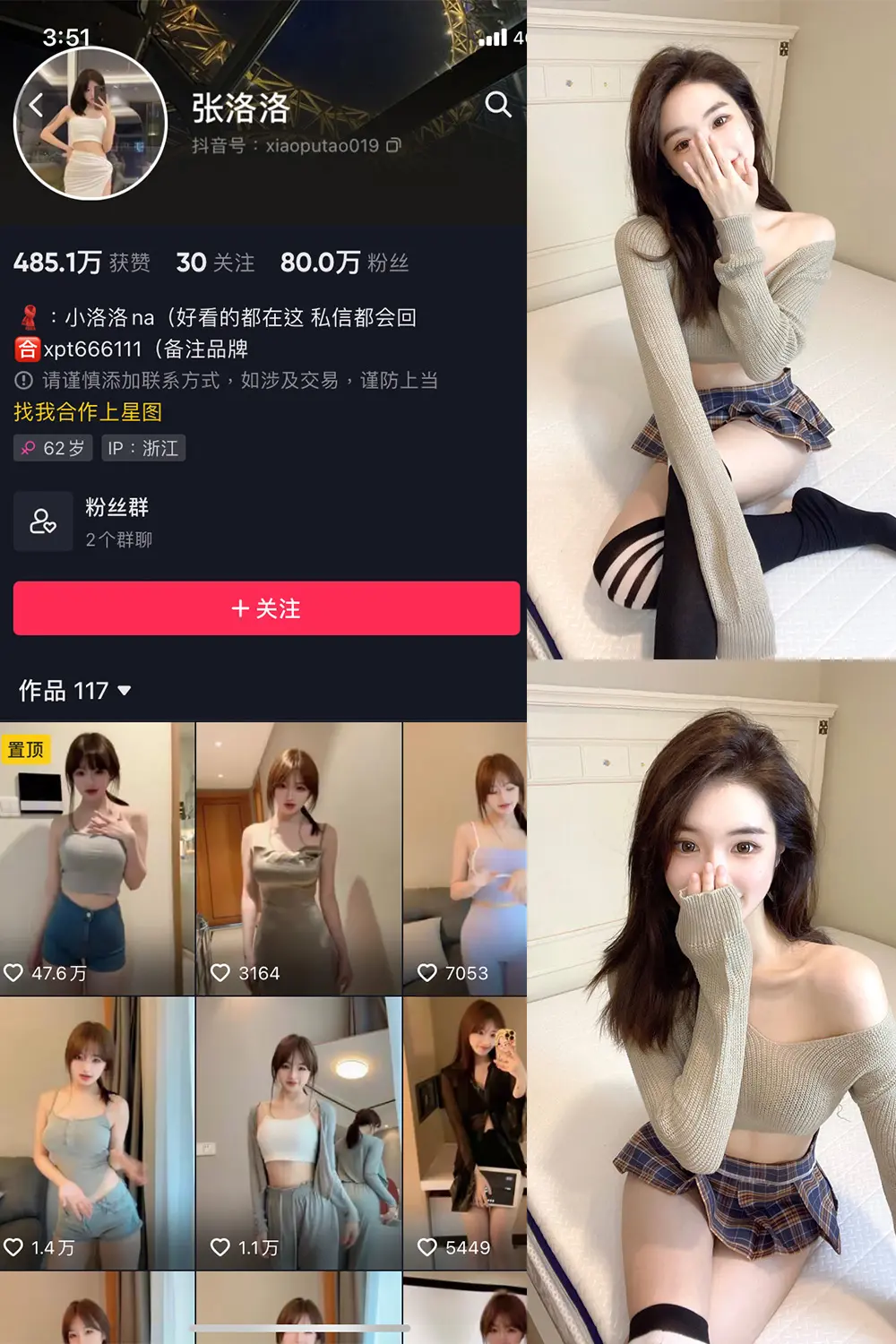 抖音 张洛洛 微密圈 NO.002期 [27P]-微密部落