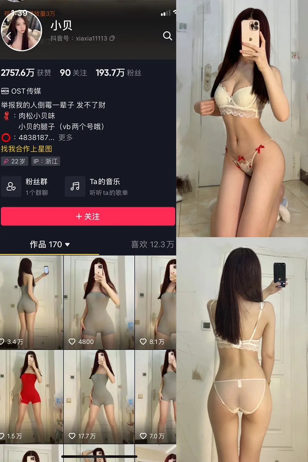 抖音 小贝 VIP 微密圈 NO.009期 [11P]-微密部落